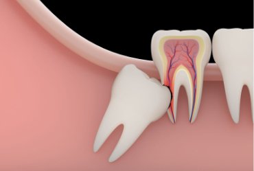 Cirugía maxilofacial