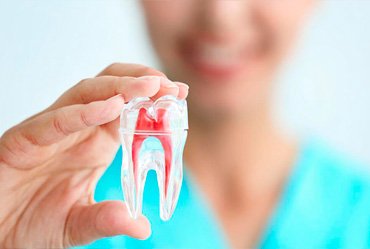 Endodoncia